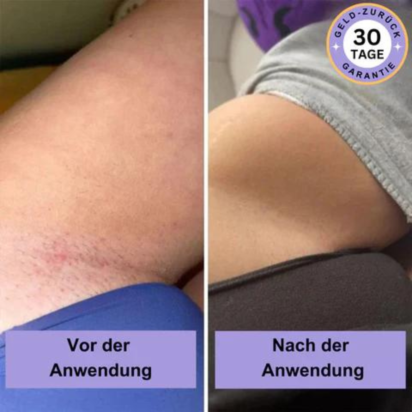 Purelis® Laserrasierer