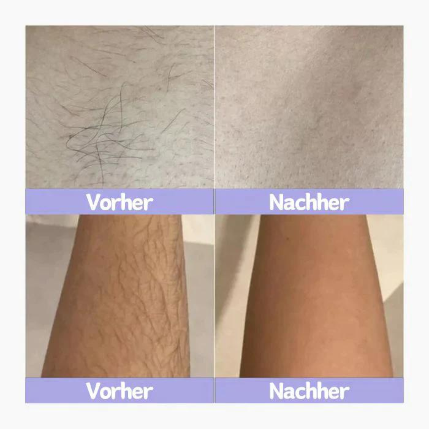 Purelis® Laserrasierer